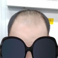 禿頂用戶圖片