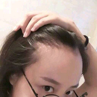 發(fā)際線用戶圖片