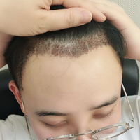 發(fā)際線用戶圖片