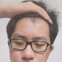 發(fā)際線用戶圖片