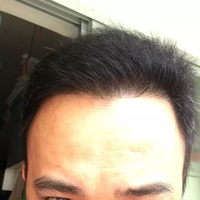 發(fā)際線用戶圖片