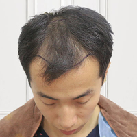 發(fā)際線用戶圖片