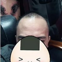 發(fā)際線用戶圖片