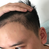 禿頂用戶圖片