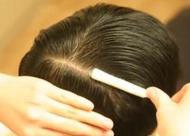  头发稀少是什么原因 头发稀少的日常护理方法
