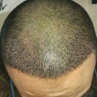 發(fā)際線用戶圖片