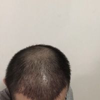 發(fā)際線用戶圖片