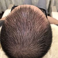 發(fā)際線用戶圖片