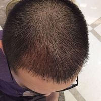 發(fā)際線用戶圖片