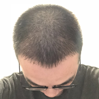 發(fā)際線用戶圖片