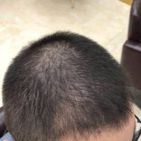 發(fā)際線用戶圖片