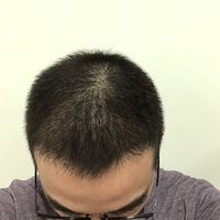 發(fā)際線用戶圖片