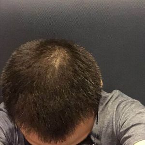 发际线分享社区
