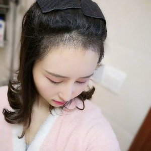 发际线分享社区