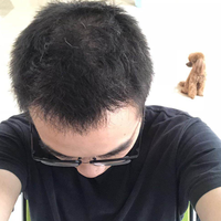 發(fā)際線用戶圖片