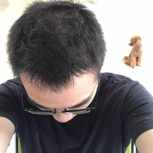 发际线分享社区