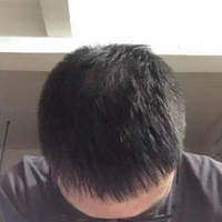 發(fā)際線用戶圖片