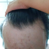 失敗修復(fù)用戶圖片