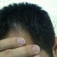 發(fā)際線用戶圖片