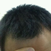 發(fā)際線用戶圖片