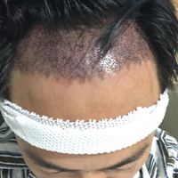發(fā)際線用戶圖片