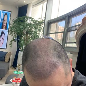 发际线分享社区
