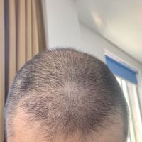 發(fā)際線用戶圖片