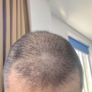 发际线分享社区