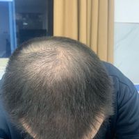 發(fā)際線用戶圖片