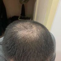 發(fā)際線用戶圖片