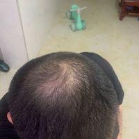 發(fā)際線用戶圖片