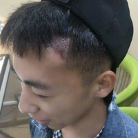 發(fā)際線用戶圖片
