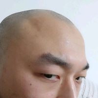 禿頂用戶圖片