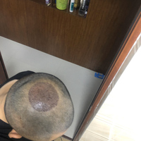 發(fā)際線用戶圖片