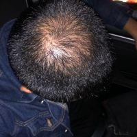 發(fā)際線用戶圖片