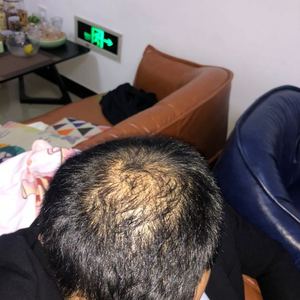 发际线分享社区
