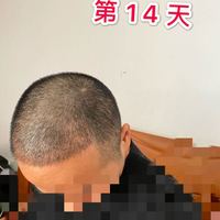 發(fā)際線用戶圖片