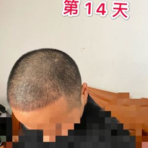 发际线分享社区