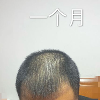 發(fā)際線用戶圖片