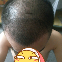 發(fā)際線用戶圖片