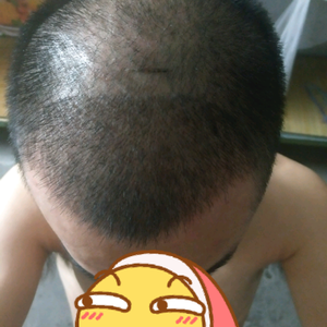 发际线分享社区