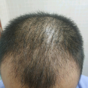 发际线分享社区