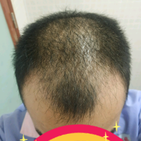 發(fā)際線用戶圖片