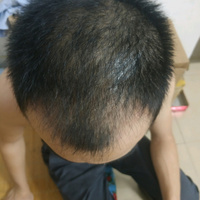 發(fā)際線用戶圖片