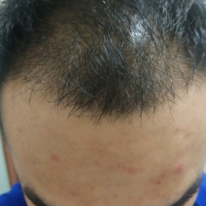 发际线分享社区