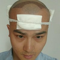 發(fā)際線用戶圖片