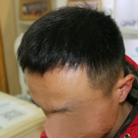 發(fā)際線用戶圖片