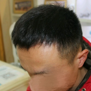 发际线分享社区