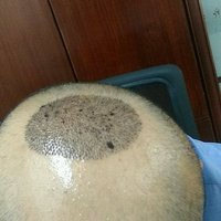 發(fā)際線用戶圖片