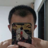發(fā)際線用戶圖片